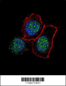 Anti-KDM6B Rabbit Polyclonal Antibody (AP (Alkaline Phosphatase))