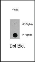 Anti-EP300 Rabbit Polyclonal Antibody