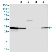 Anti-STARD10 Rabbit Polyclonal Antibody