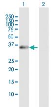 Anti-XPA Mouse Polyclonal Antibody