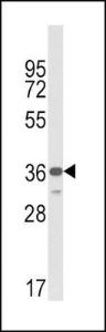 Anti-MHC Class 1 Chain-related Gene A Rabbit Polyclonal Antibody (PE (Phycoerythrin))