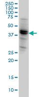 Anti-NODAL Mouse Monoclonal Antibody [clone: 5A3]