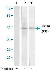 Anti-CK18 Rabbit Polyclonal Antibody