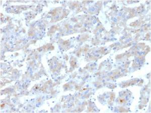 Immunohistochemical analysis of formalin-fixed, paraffin-embedded human liver using Anti-Apolipoprotein B Antibody [APOB/3300]