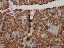 Anti-MTM1 Mouse Monoclonal Antibody [clone: 1C10]