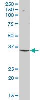 Anti-XPA Mouse Polyclonal Antibody