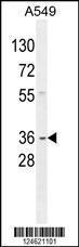 Anti-GNAT3 Rabbit Polyclonal Antibody