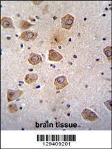 Anti-CLVS2 Rabbit Polyclonal Antibody