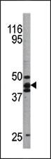 Anti-TP53 Rabbit Polyclonal Antibody