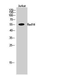 Western blot analysis of Jurkat cells using Anti-RAD18 Antibody