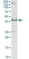 Anti-VRK1 Polyclonal Antibody Pair