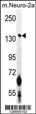 Anti-CAMSAP1 Rabbit Polyclonal Antibody (APC (Allophycocyanin))