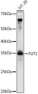 Anti-FUT2 antibody