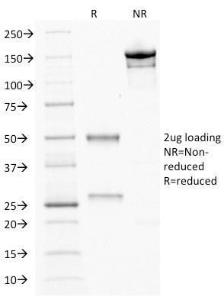 Antibody anti-CDX2 CDX21690 100 µg