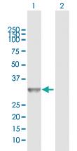 Anti-CCND2 Rabbit Polyclonal Antibody