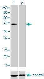 Anti-MTM1 Mouse Monoclonal Antibody [clone: 1C10]