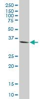 Anti-GSC Mouse Monoclonal Antibody [clone: 2C1]