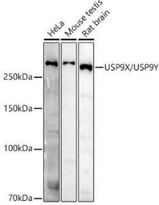 Western blot analysis of extracts of various cell lines, using Anti-USP9Y Antibody (A309204) at 1:500 dilution