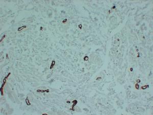 Antibody anti-smooth muscle actin ABT-S