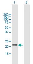 Anti-GM2A Mouse Polyclonal Antibody