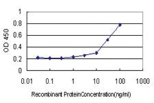 Anti-MTM1 Mouse Monoclonal Antibody [clone: 1C10]