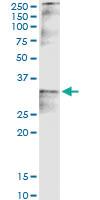 Anti-CCND2 Rabbit Polyclonal Antibody