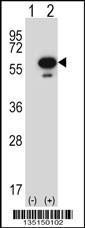 Anti-STK25 Rabbit Polyclonal Antibody (AP (Alkaline Phosphatase))