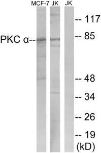 Western blot analysis of lysates from Jurkat and MCF-7 cells using Anti-PKC alpha Antibody. The right hand lane represents a negative control, where the antibody is blocked by the immunising peptide