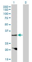 Anti-CCND2 Rabbit Polyclonal Antibody