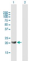 Anti-GM2A Mouse Polyclonal Antibody