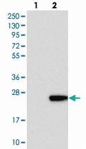 Anti-C1orf64 Rabbit Polyclonal Antibody