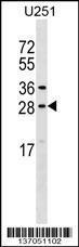 Anti-OSTF1 Rabbit Polyclonal Antibody (AP (Alkaline Phosphatase))