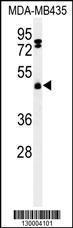 Anti-FBXL2 Rabbit Polyclonal Antibody (Biotin)