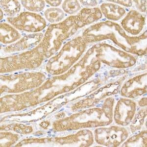 Immunohistochemistry analysis of paraffin-embedded mouse kidney using Anti-USP9Y Antibody (A309204) at a dilution of 1:100 (40x lens). Perform high pressure antigen retrieval with 10 mM citrate buffer pH 6.0 before commencing with IHC staining protocol