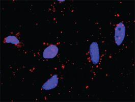 Anti-STK36 + SUFU Antibody Pair