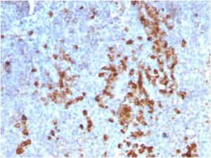 Immunohistochemical analysis of formalin-fixed, paraffin-embedded human tonsil using Anti-Kappa Light Chain Antibody [rKLC709]