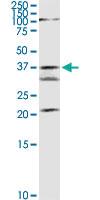 Anti-GMDS Rabbit Polyclonal Antibody