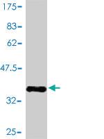 Anti-RAMP3 Mouse Monoclonal Antibody [clone: 1C11]