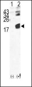 Anti-Microglobulin Rabbit Polyclonal Antibody