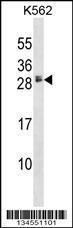 Anti-HBEGF Rabbit Polyclonal Antibody (HRP (Horseradish Peroxidase))