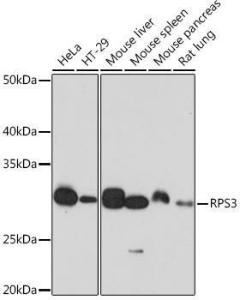 Western blot analysis of extracts of various cell lines, using Anti-RPS3 Antibody [ARC0302] (A305397) at 1:1,000 dilution