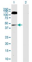 Anti-GMDS Rabbit Polyclonal Antibody