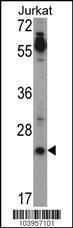 Anti-TDGF1 Rabbit Polyclonal Antibody