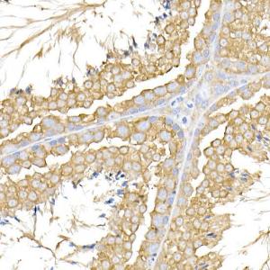 Immunohistochemistry analysis of paraffin-embedded mouse testis using Anti-USP9Y Antibody (A309204) at a dilution of 1:100 (40x lens). Perform high pressure antigen retrieval with 10 mM citrate buffer pH 6.0 before commencing with IHC staining protocol