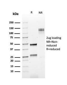 SDS-PAGE analysis of Anti-Kappa Light Chain Antibody [rKLC709] under non-reduced and reduced conditions; showing intact IgG and intact heavy and light chains, respectively SDS-PAGE analysis confirms the integrity and purity of the antibody