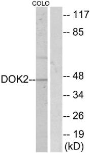 Western blot analysis of lysates from COLO205 using Anti-p56 Dok-2 Antibody. The right hand lane represents a negative control, where the antibody is blocked by the immunising peptide.