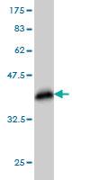 Anti-FBXO11 Mouse Monoclonal Antibody [clone: 4C12]