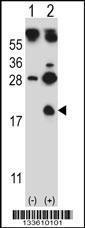 Anti-HBG1 Rabbit Polyclonal Antibody (Biotin)