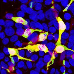 HEK293 cells transfected in the same way and viewed in the confocal microscope. Most HEK293 cells are not transfected so only the nucleus of these cells can be visualized with a blue DNA stain. Cells which are transfected with Cherry are bright red