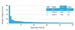 Analysis of protein array containing more than 19,000 full-length human proteins using Anti-Kappa Light Chain Antibody [rKLC709] Z-Score and S- Score